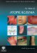 An Atlas of Atopic Eczema cover