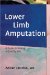 Lower Limb Amputation : A Guide to Living a Quality Life cover