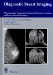 Diagnostic Breast Imaging : Mammography, Sonography, Magnetic Resonance Imaging, and Interventional Procedures cover