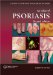 An Atlas of Psoriasis cover
