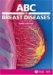 Abc Of Breast Diseases cover
