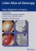 Color Atlas of Otoscopy : From Diagnosis to Surgery cover