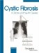Cystic Fibrosis : A State-Of-The-Art Series cover