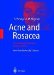 Acne and Rosacea cover