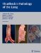 Thurlbeck's Pathology Of The Lung cover