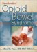 Handbook of Opioid Bowel Syndrome cover