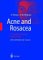 Acne and Rosacea cover