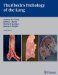 Pathology of the Lung cover
