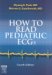  How to Read Pediatric ECGs