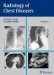 Radiology of Chest Diseases cover