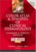 Color Atlas and Synopsis of Clinical Dermatology : Common and Serious Diseases cover