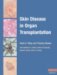  Skin Disease In Organ Transplantation