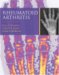 Rheumatoid Arthritis cover