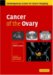  Cancer of The Ovary