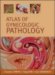 Atlas Of Gynecologic Pathology cover