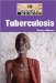 Tuberculosis cover
