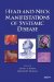 Head And Neck Manifestations of Systemic Disease cover