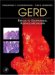  Gerd: Reflux to Esophageal Adenocarcinoma