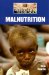 Malnutrition cover