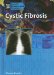 Cystic Fibrosis cover