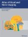Atlas of Head and Neck Imaging : The Extracranial Head and Neck cover