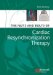 The Nuts and Bolts of Cardiac Resynchronization Therapy cover