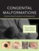 Congenital Malformations : Evidence-based Evaluation and Management cover