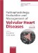 Pathophysiology, Evaluation and Management of Valvular Heart Disease cover