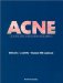 Acne : Diagnosis and Management cover