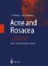 Acne and Rosacea cover