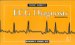 Pocket Guide to Ecg Diagnosis cover