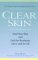 Clear Skin : Heal Your Own Skin and End the Breakouts--Once and for All cover