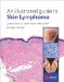 An Illustrated Guide to Skin Lymphoma cover