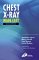  Chest X-Ray Made Easy
