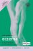 Your Guide to Eczema cover