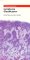 The Pocket Guide to Lymphoma Classification cover