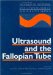 Ultrasound and the Fallopian Tube cover