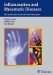 Inflammation and Rheumatic Diseases : The Molecular Basis of Novel Therapies cover