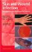 Skin And Wound Infection : Investigation And Treatment in Practice cover
