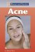 Acne cover