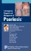 Contemporary Diagnosis And Management Of Psoriasis cover