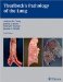 Thurlbeck's Pathology Of The Lung cover