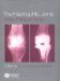 The Haemophilic Joints : New Perspectives cover