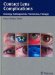 Contact Lens Complications : Etiology, Pathogenesis, Prevention, Therapy cover
