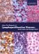 The Diagnosis of Lymphoproliferative Diseases : An Atlas cover