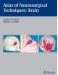 Atlas of Neurosurgical Techniques cover
