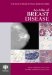 An Atlas of Breast Disease cover