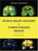 Human Brain Anatomy In Computerized Images cover