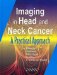 Imaging Of Head And Neck Cancer cover