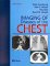  Imaging of Diseases of the Chest